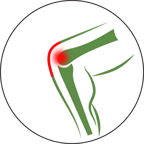 Best Relief For Arthritic Knees - DICLOWIN Knee Oil